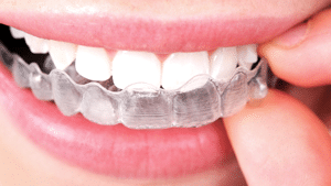 Invisalign Icon Orthodontics Surprise Glendale AZ