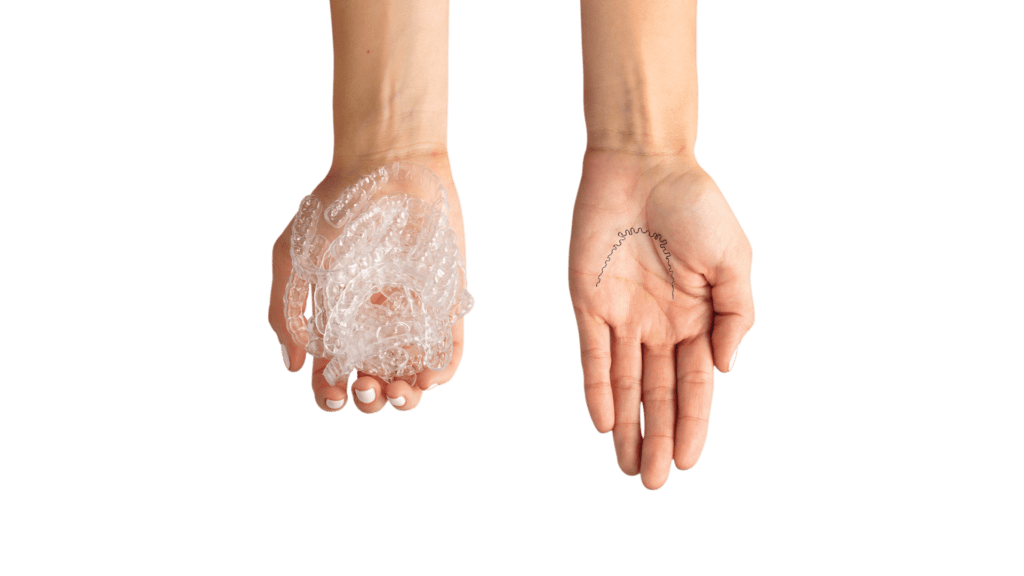 aligners vs inbrace