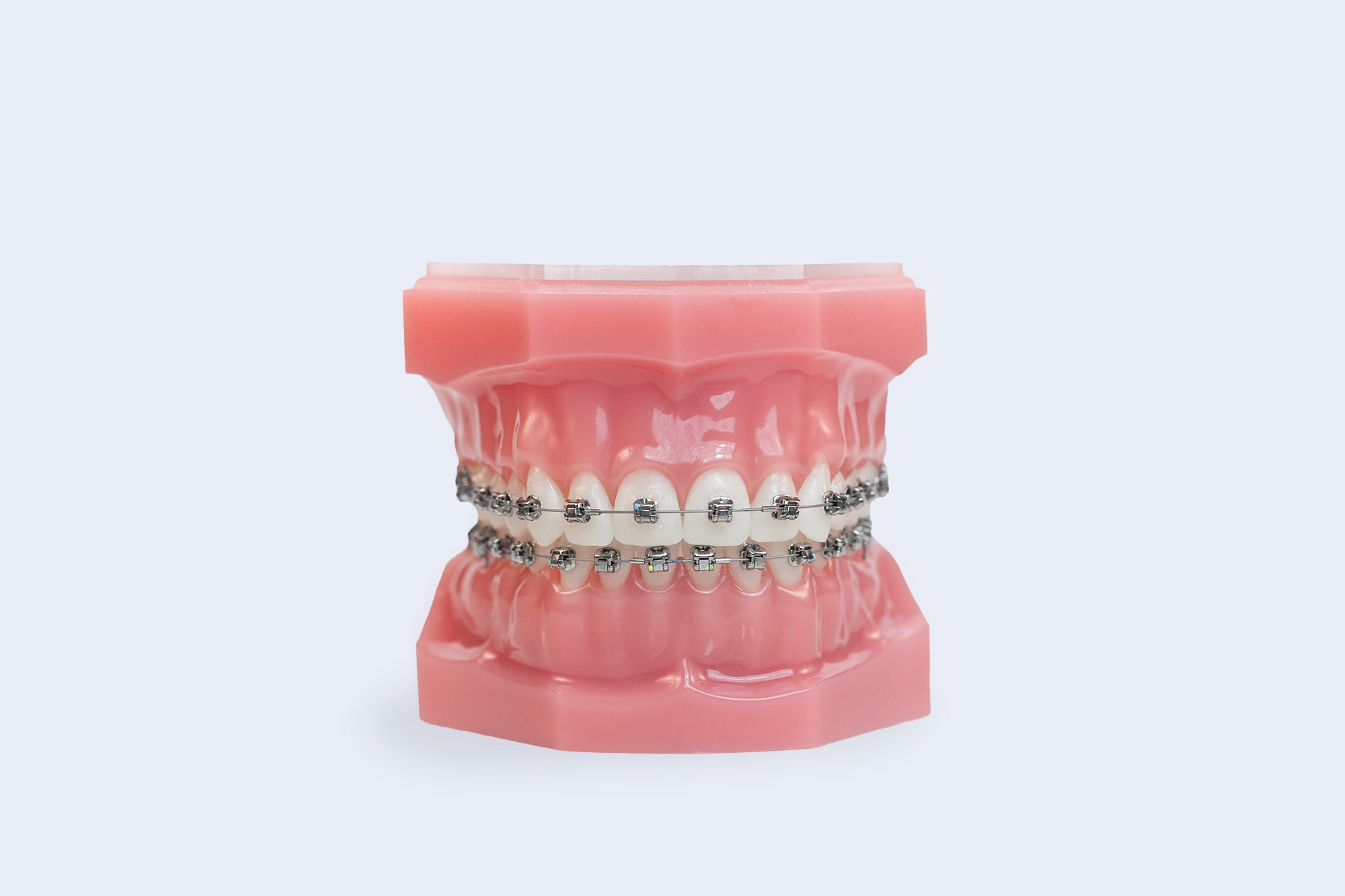 clear braces with purple bands