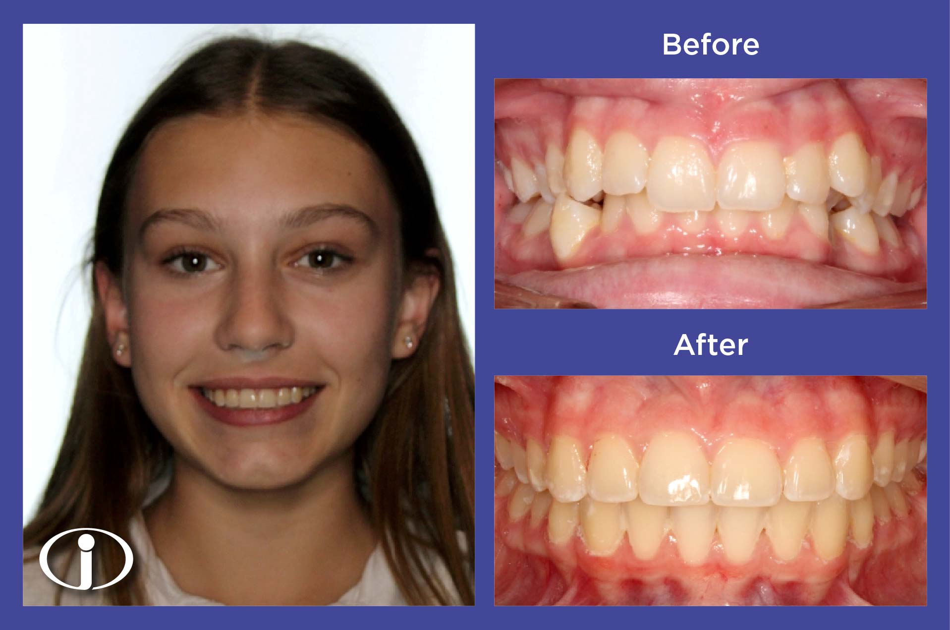 2026-1-28_IconOrtho_B&APhotos_ES_BI20