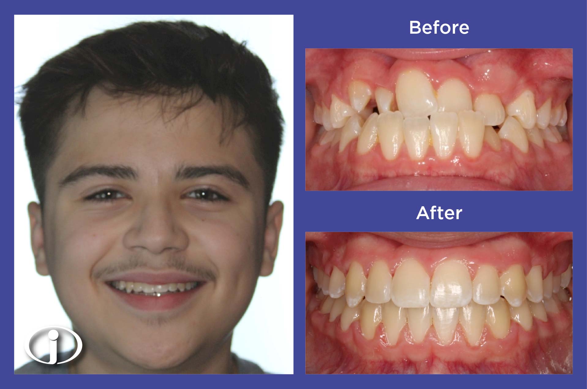 2026-1-28_IconOrtho_B&APhotos_ES_CH44