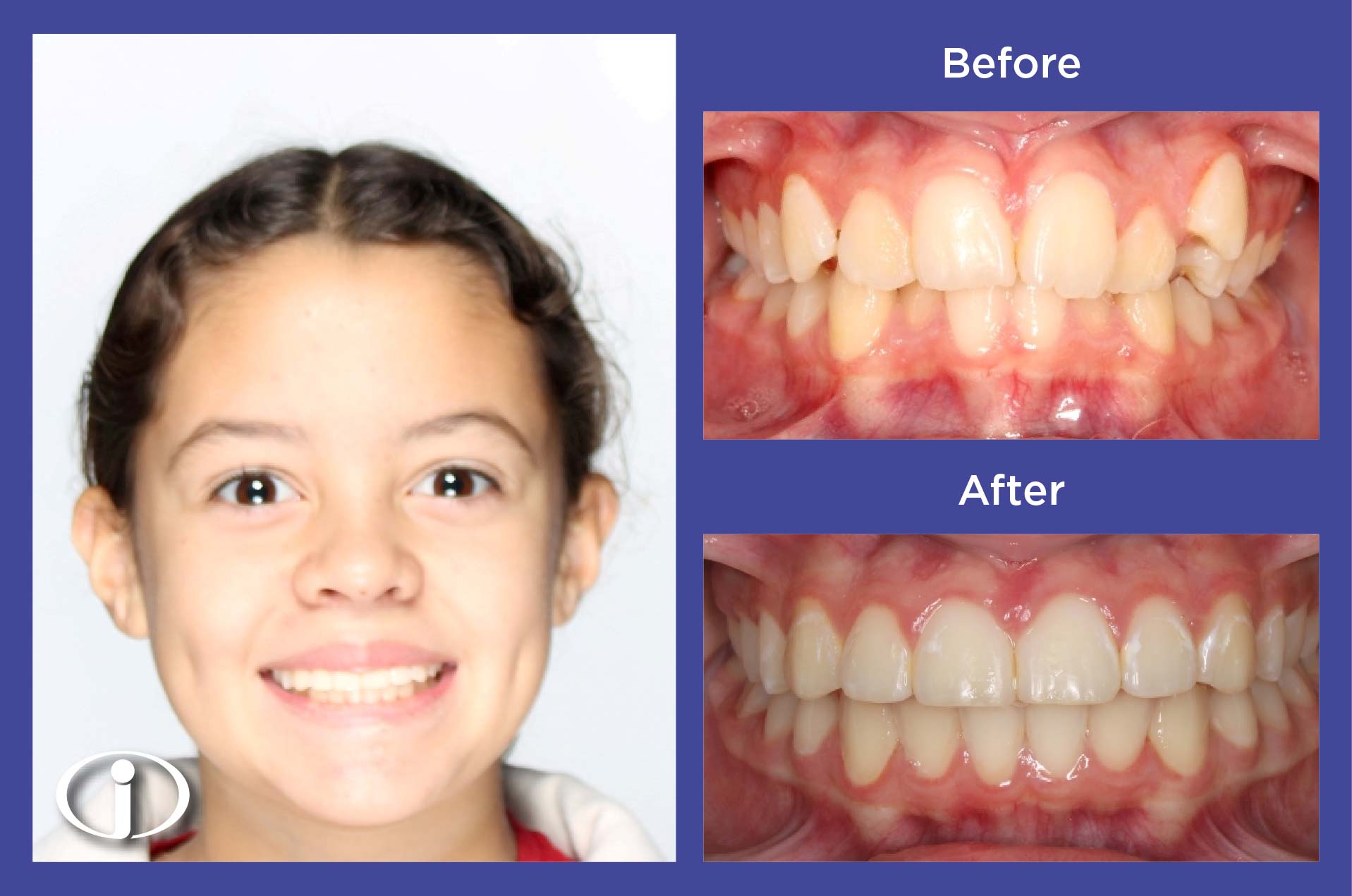 2026-1-28_IconOrtho_B&APhotos_ES_ES26