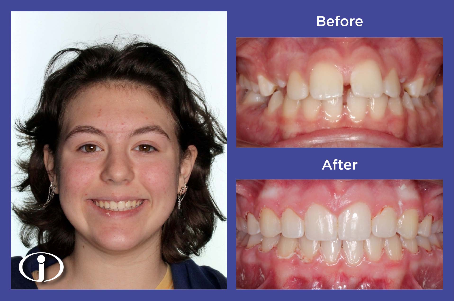 2026-1-28_IconOrtho_B&APhotos_ES_LE30