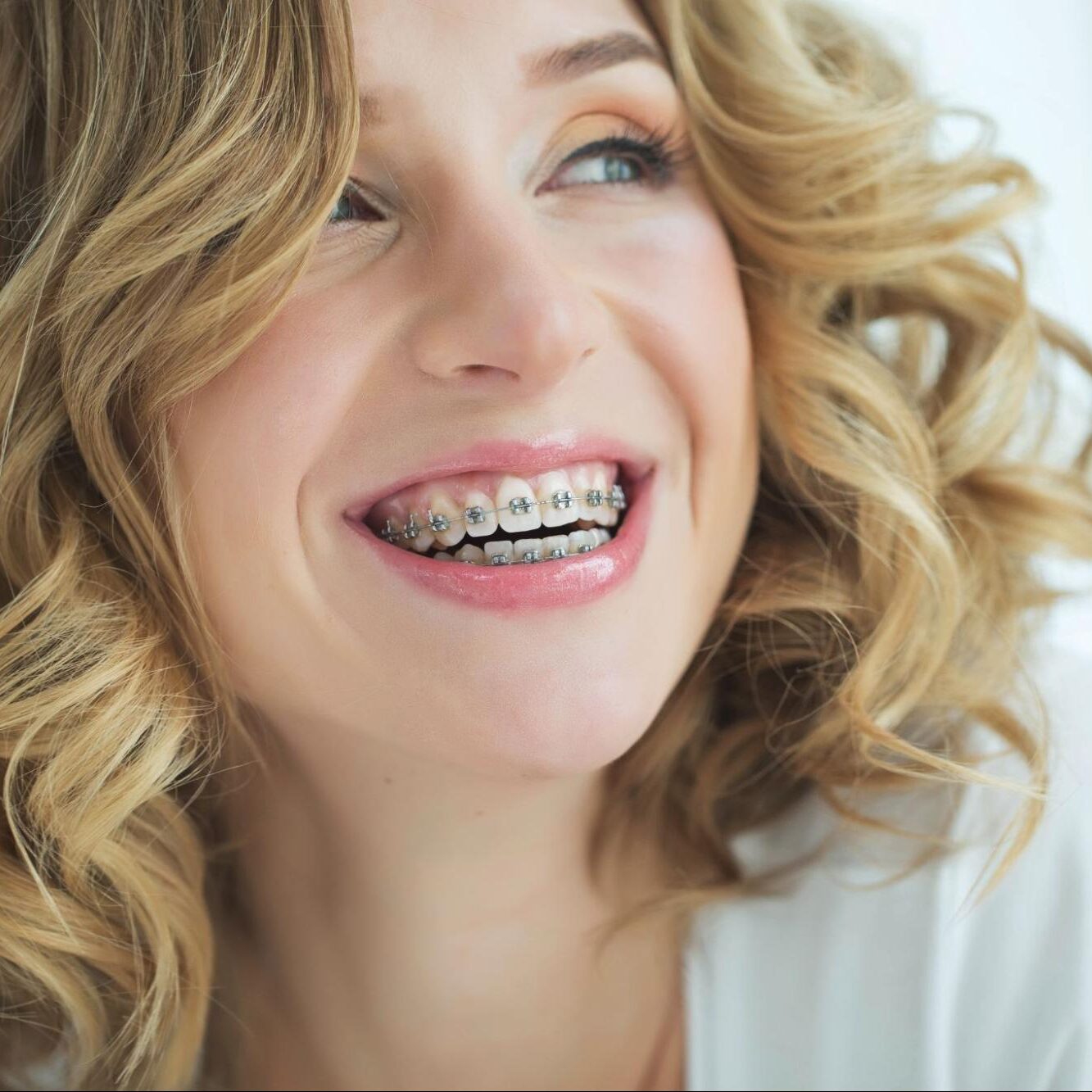 Should I Choose Braces or Clear Aligners?